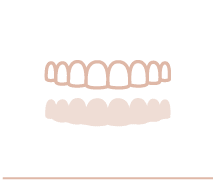 Aligner Behandlung